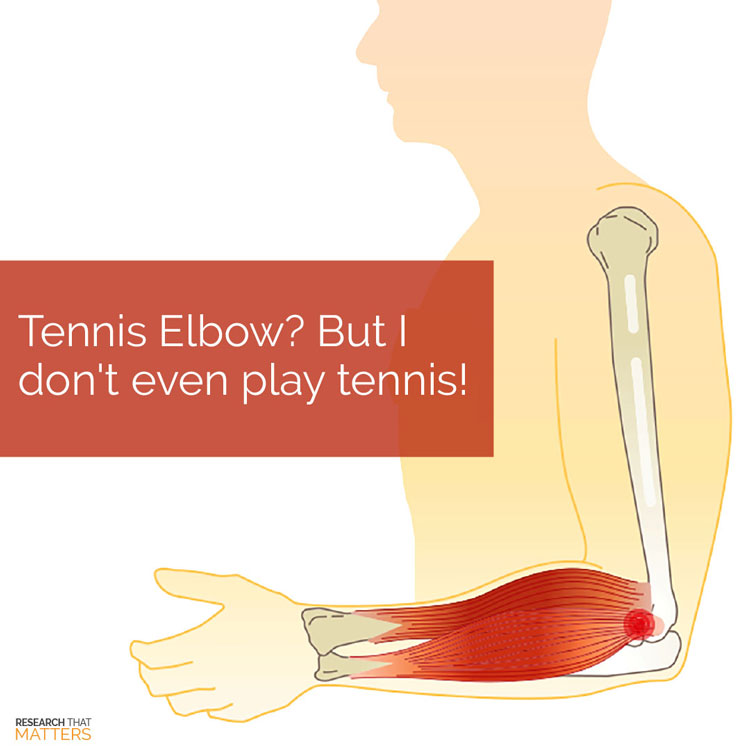 Chiropractic Coral Springs FL Tennis Elbow