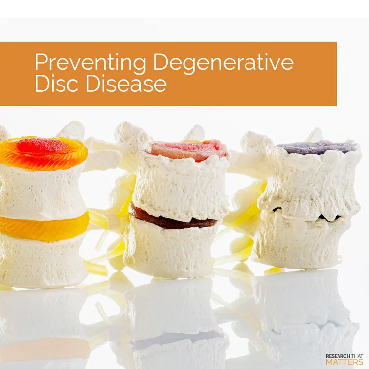 Preventing Degenerative Disc Disease in Coral Springs FL