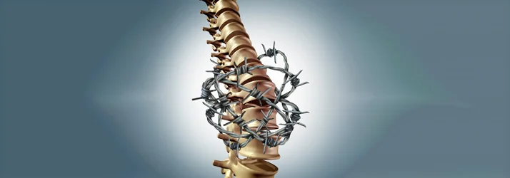 Surgery For Low Back Pain? Think Twice in Coral Springs FL Surgery For Low Back Pain? Think Twice in Coral Springs FL